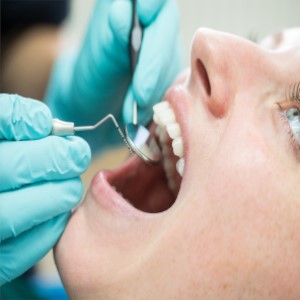 يُمكن أن يُؤدي التسوس إلى مضاعفات
خطيرة إذا لم يتم علاجه في الوقت المناسب